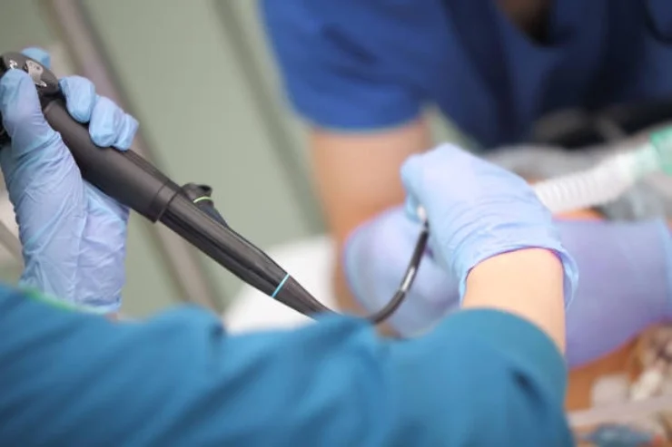 Bronchoscopy