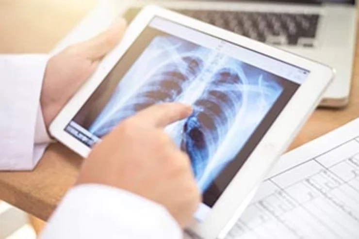 Interventional Pulmonology Services