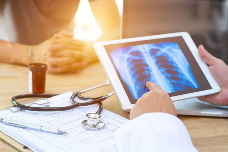 Lung Cancer Screening and Management