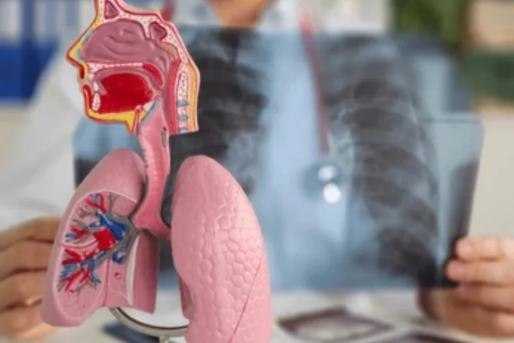 Management of Chronic Respiratory Conditions